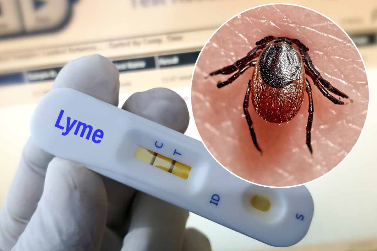 Êtes-vous porteur de la maladie de Lyme sans le savoir ?