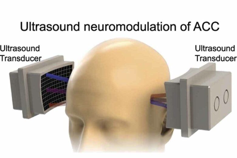 Une stimulation par ultrasons pour atténuer les douleurs liées à la dépression.