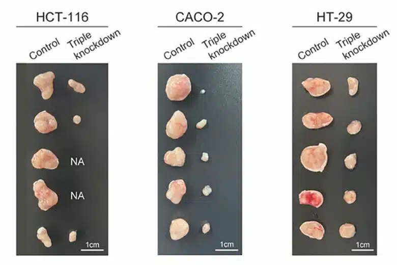 Des cellules cancéreuses traitées ont diminué de volume.