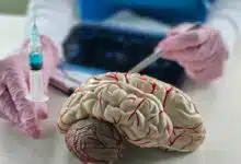 Un médecin explique les bienfaits d'un traitement par injection sur le cerveau.